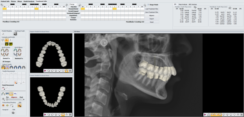Before orthodontic treatment