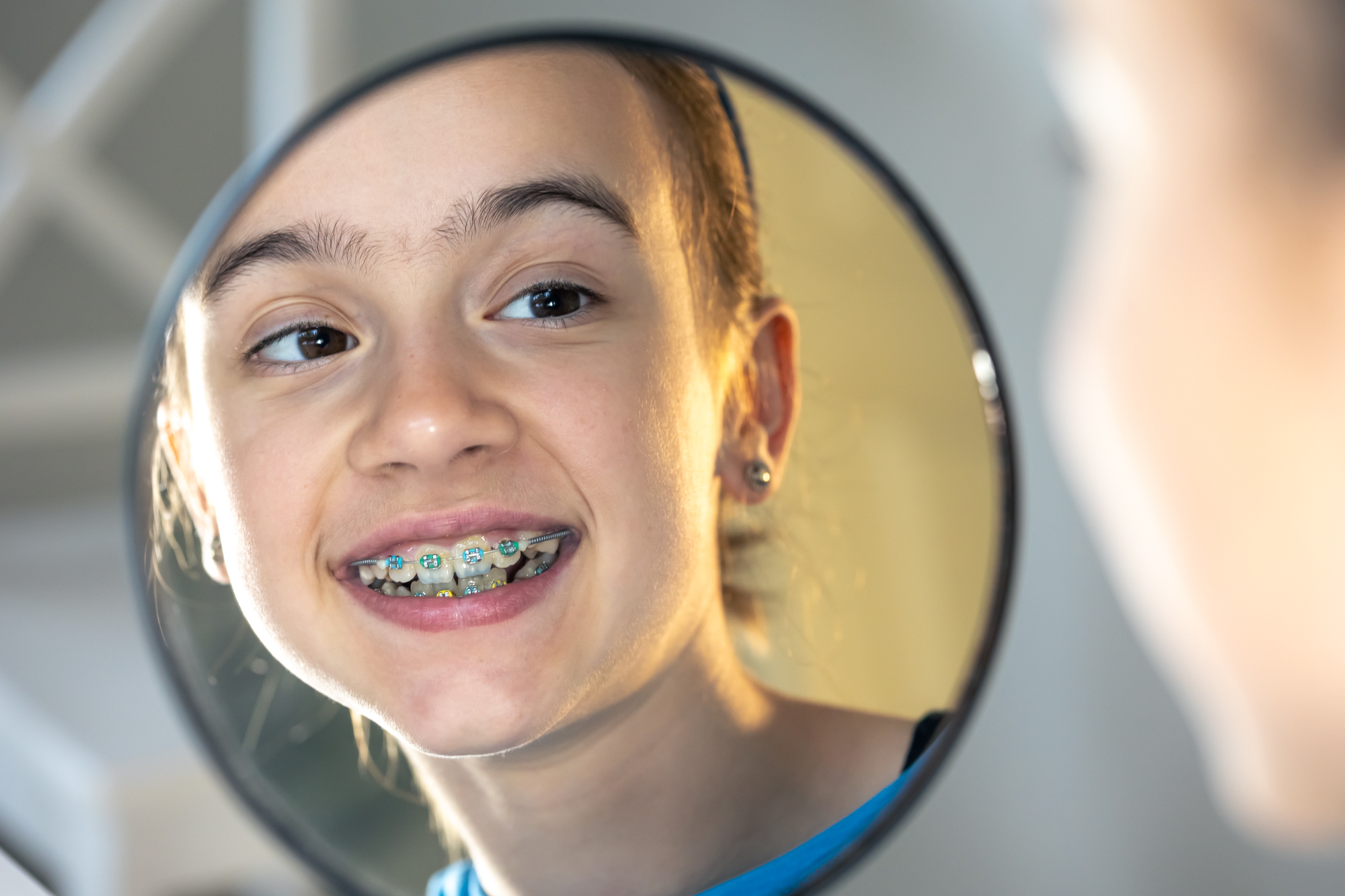 38351 - The Wireworks Orthodontics