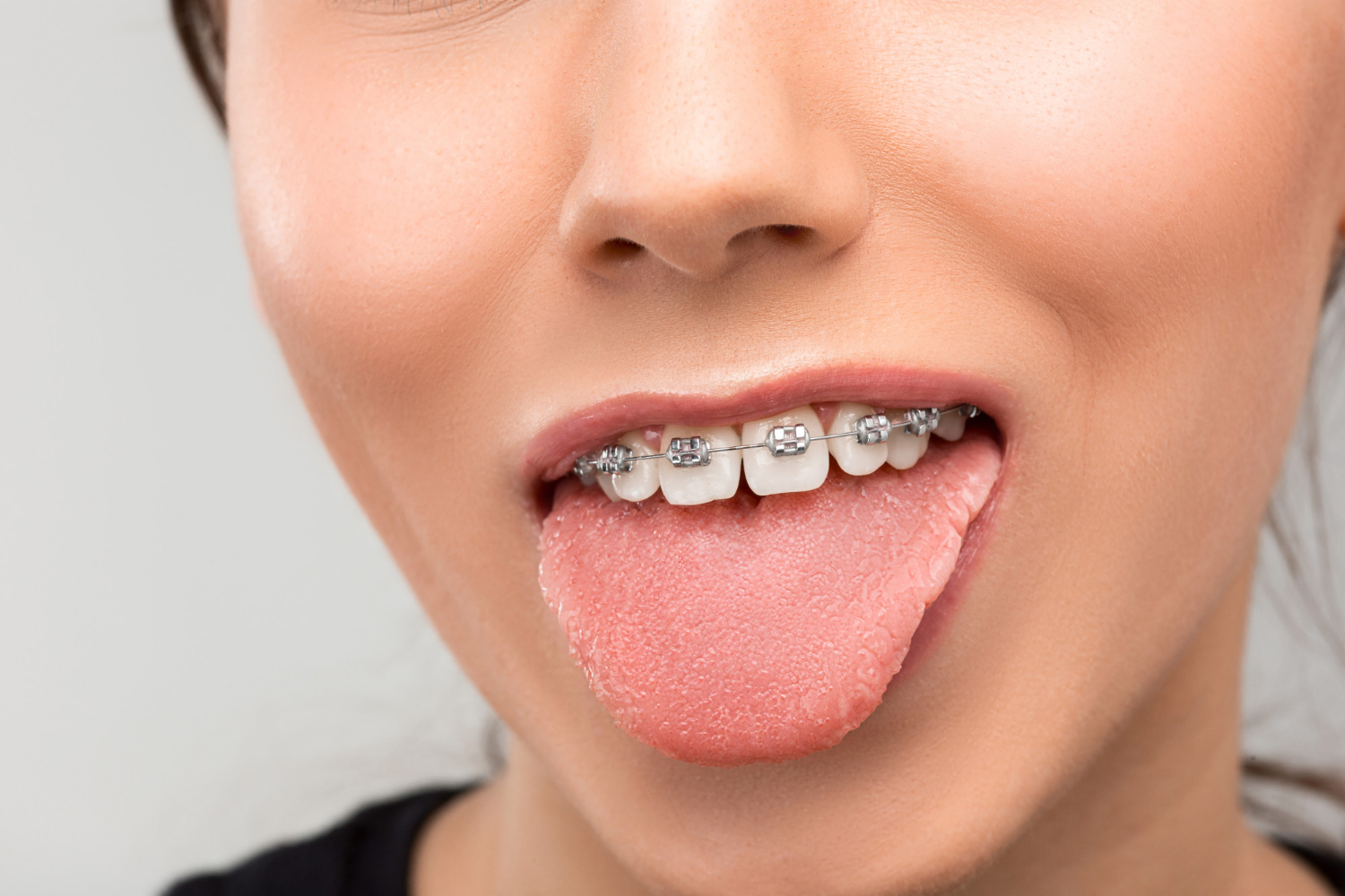 1048 - The Wireworks Orthodontics