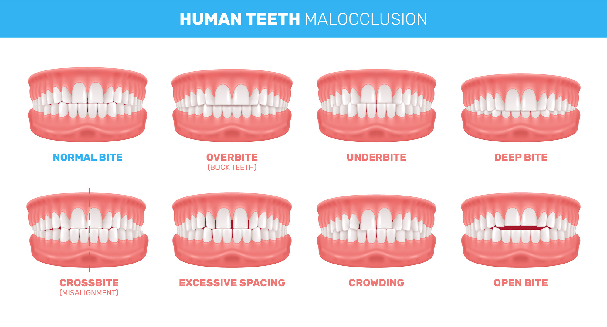 Teeth alignment and orthodontic care