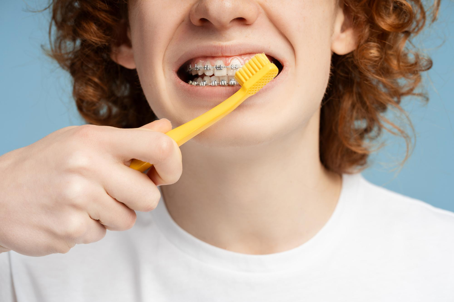 8481 - The Wireworks Orthodontics