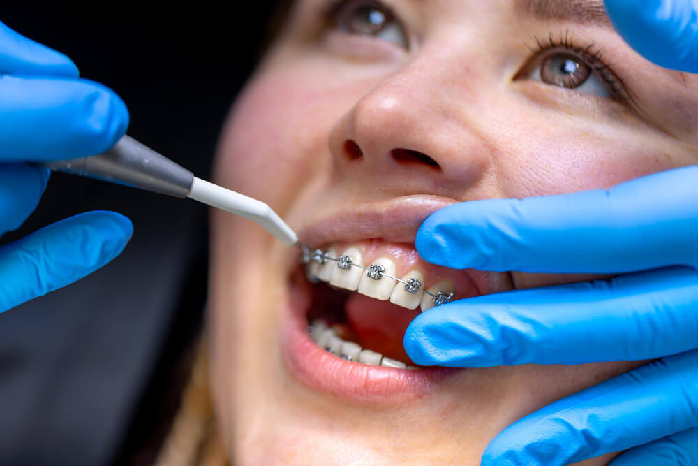 67279 1 1 - orthodontic care at The Wireworks